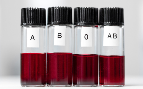 Vědci našli spojitost mezi krevní skupinou a rizikem mrtvice: Co potřebujete vědět?! Jste v ohrožení?