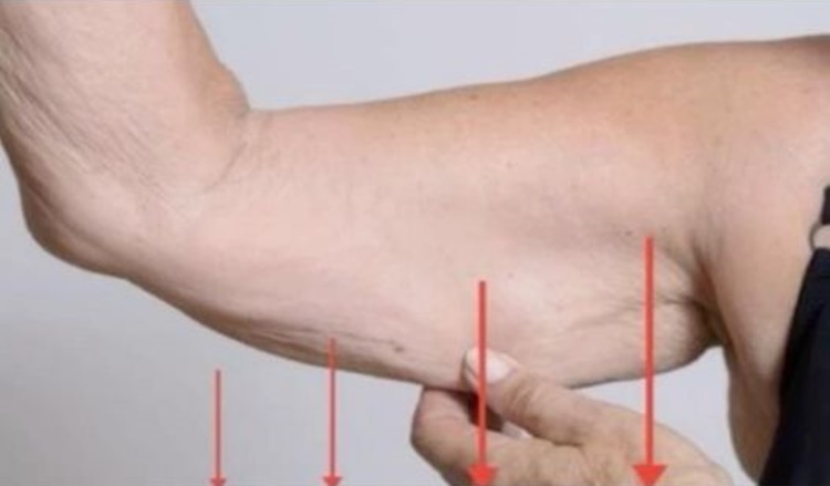 PROTO MÁTE PŘIROZENĚ POVOLENOU KŮŽI. Většina lidí o tomto problému nemá ani ponětí