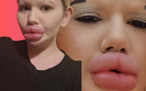 Mladá influencerka utratila jmění, aby vypadala jako panenka. Výsledek moc nevyšel!?