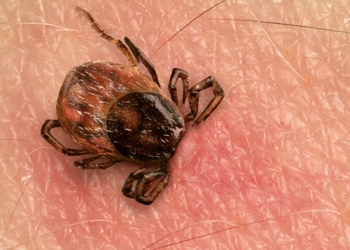 Počasí klíšťatům přeje Odborníci radí, na jaké příznaky si dát pozor po kousnutí