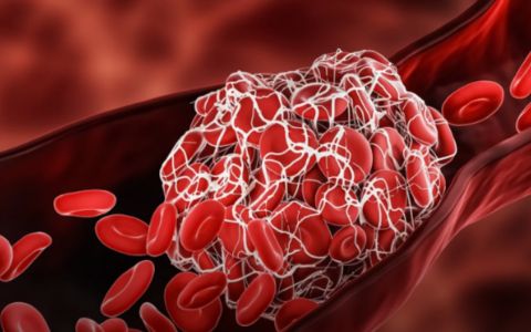 Lékař: Vše, co potřebujete vědět o nedostatku vitaminu D
