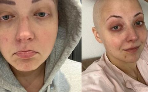 Anička Slováčková prožívá těžké chvíle. Boj s vážnou nemocí si vybírá svou daň