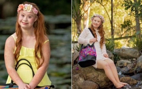 Mladá dívka s Downovým syndromem se stala úspěšnou modelkou: Nepodlehla posměchu a splnila si svůj sen!