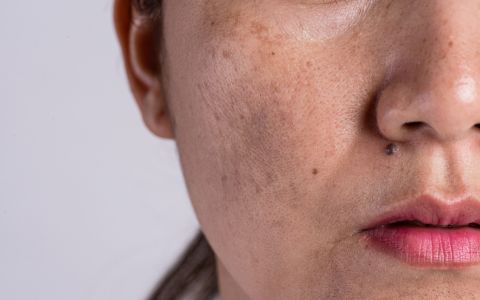 4 návyky, které vedou k předčasnému stárnutí pleti