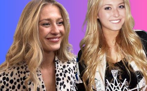 Modelka Natálie Kotková (30) má tělo samou modřinu
