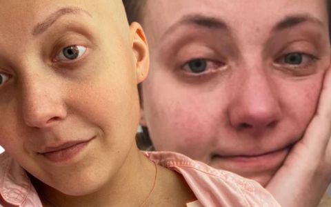 Anna Slováčková se nevzdává: „Spolu tu potvoru porazíme!“