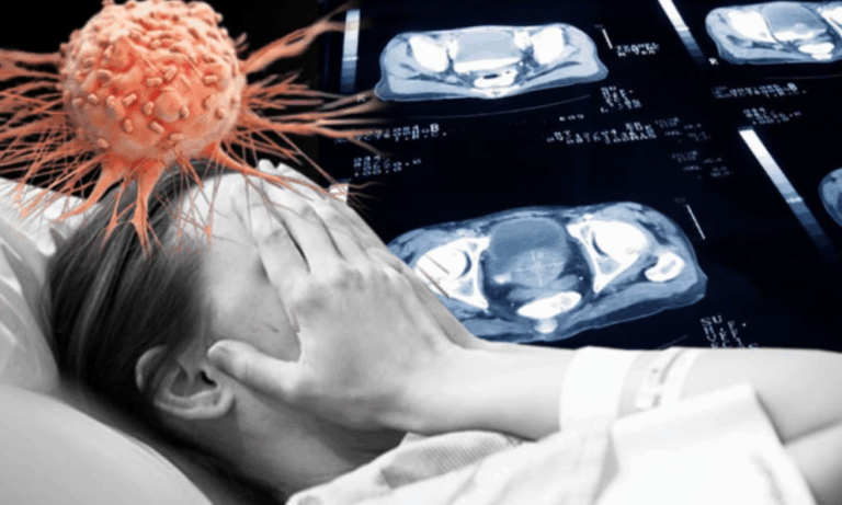 ALARM PRO ZDRAVÍ SVĚTA! Odborníci bijí na poplach: Čeká nás CELOSVĚTOVÁ EXPLOZE RAKOVINY – 75% nárůst úmrtí do roku 2050!