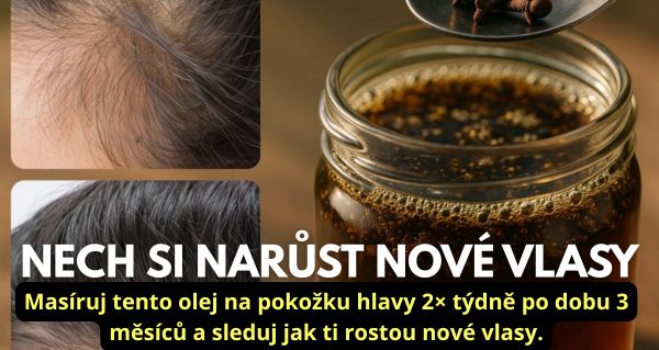 Tajemství hustých a rychle rostoucích vlasů: Vyrob si doma zázračný olej z hřebíčku a černého kmínu!