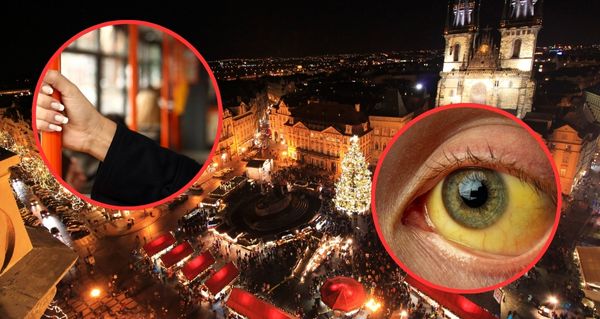 Žloutenka v Česku sílí. Přijde zásadní zlom před Vánoci? Hygiena varuje, odborníci mluví jasně