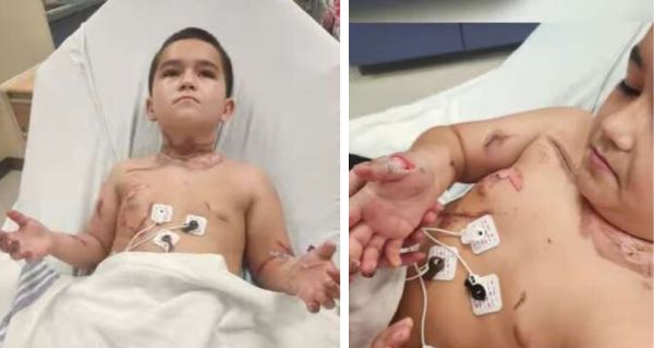 Osmiletý chlapec bojoval o život: Obyčejný řetízek se změnil v smrtící past!