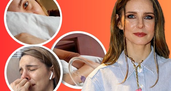 Tohle nečekala: Po botoxu přišly vážné potíže