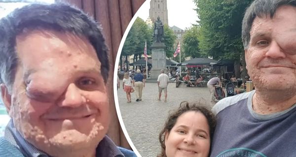 Z posměchu k respektu: Jak Oliver otočil svůj osud
