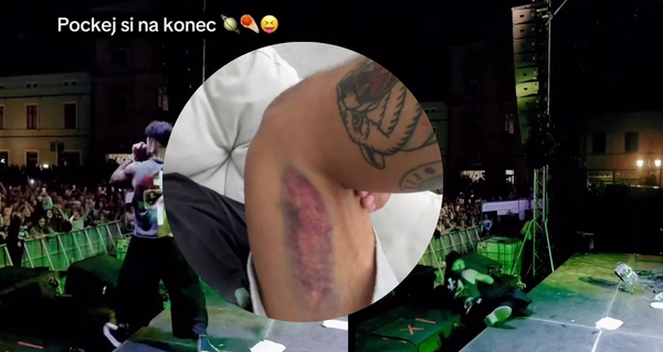 Ben Cristovao vyděsil fanoušky: Přímo během koncertu se zřítil z pódia! Pak ukázal bolestivý následek